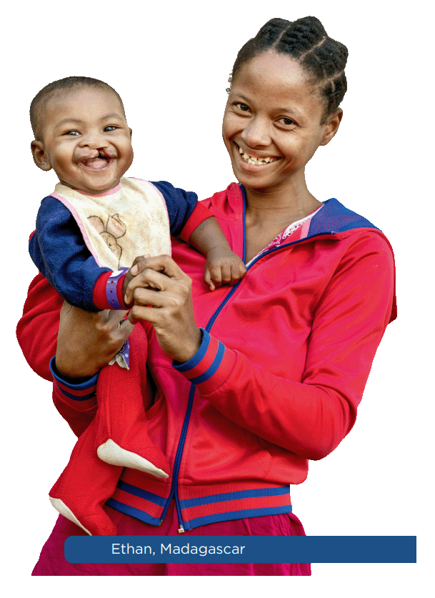A mother and her child &mdash; Operation Smile